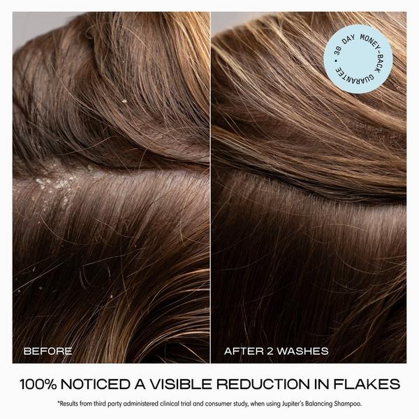 JUPITER Anti-Dandruff Balancing Shampoo #4