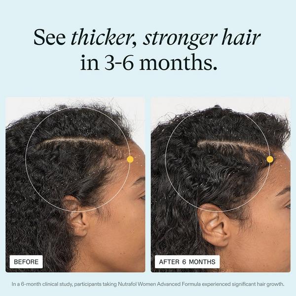 NUTRAFOL Women Daily Hair Health Routine Set #4
