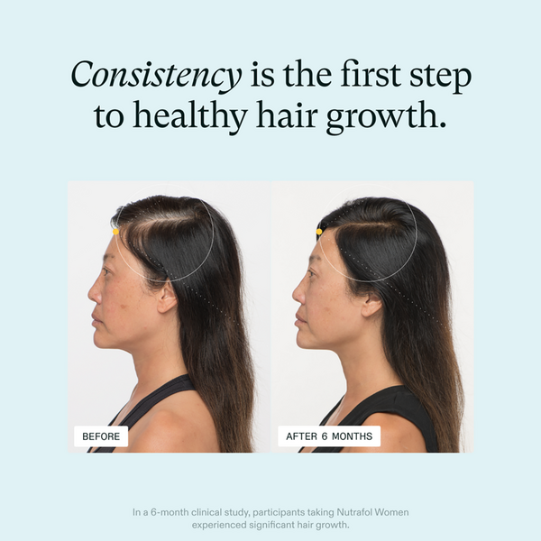 NUTRAFOL Women's 18-44 Clinically Proven Hair Growth Supplement #3