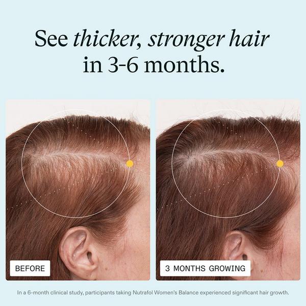 NUTRAFOL Women's Balance Daily Hair Health Routine Set #4