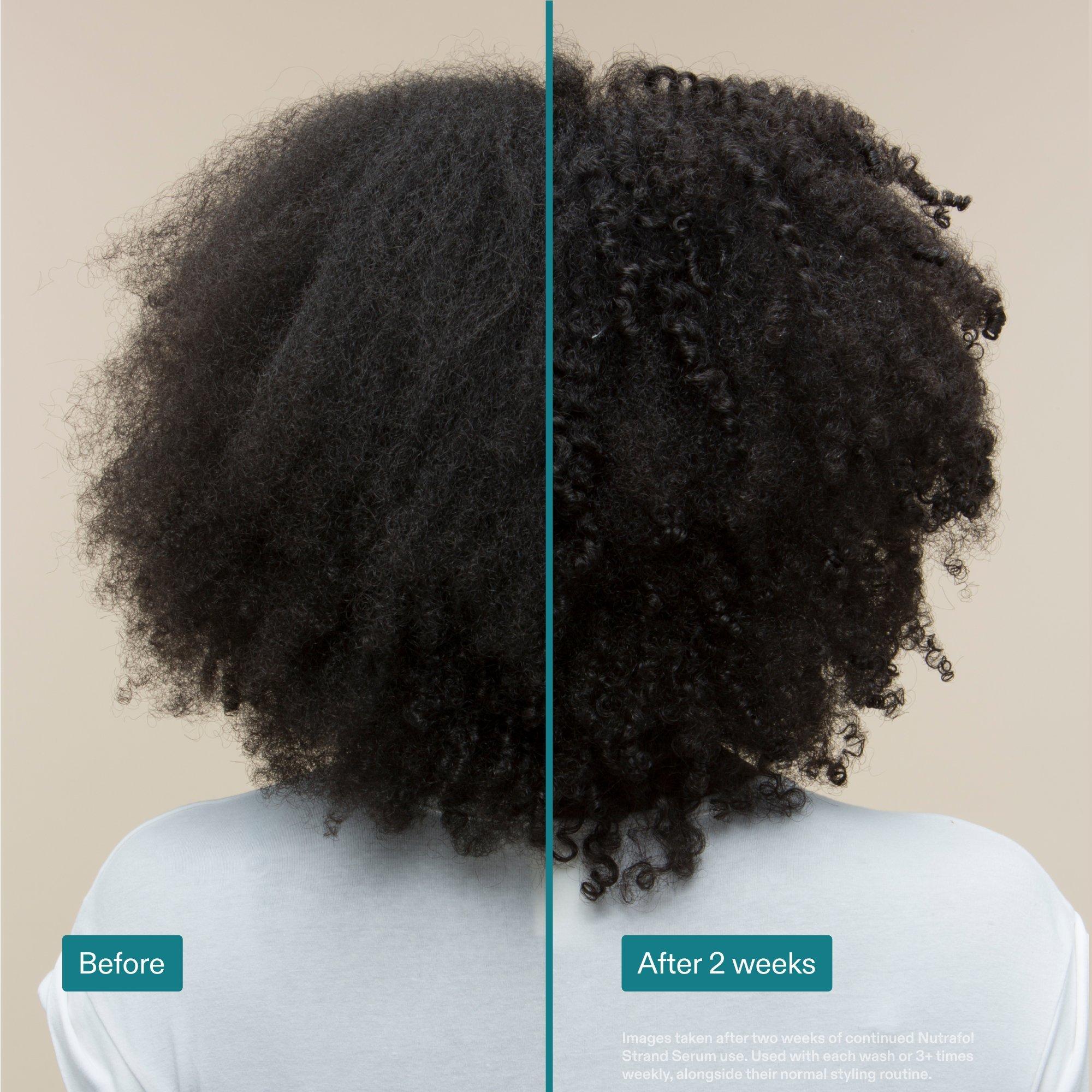 NUTRAFOL Strand Serum Hair Strengthening Kit — фото 3
