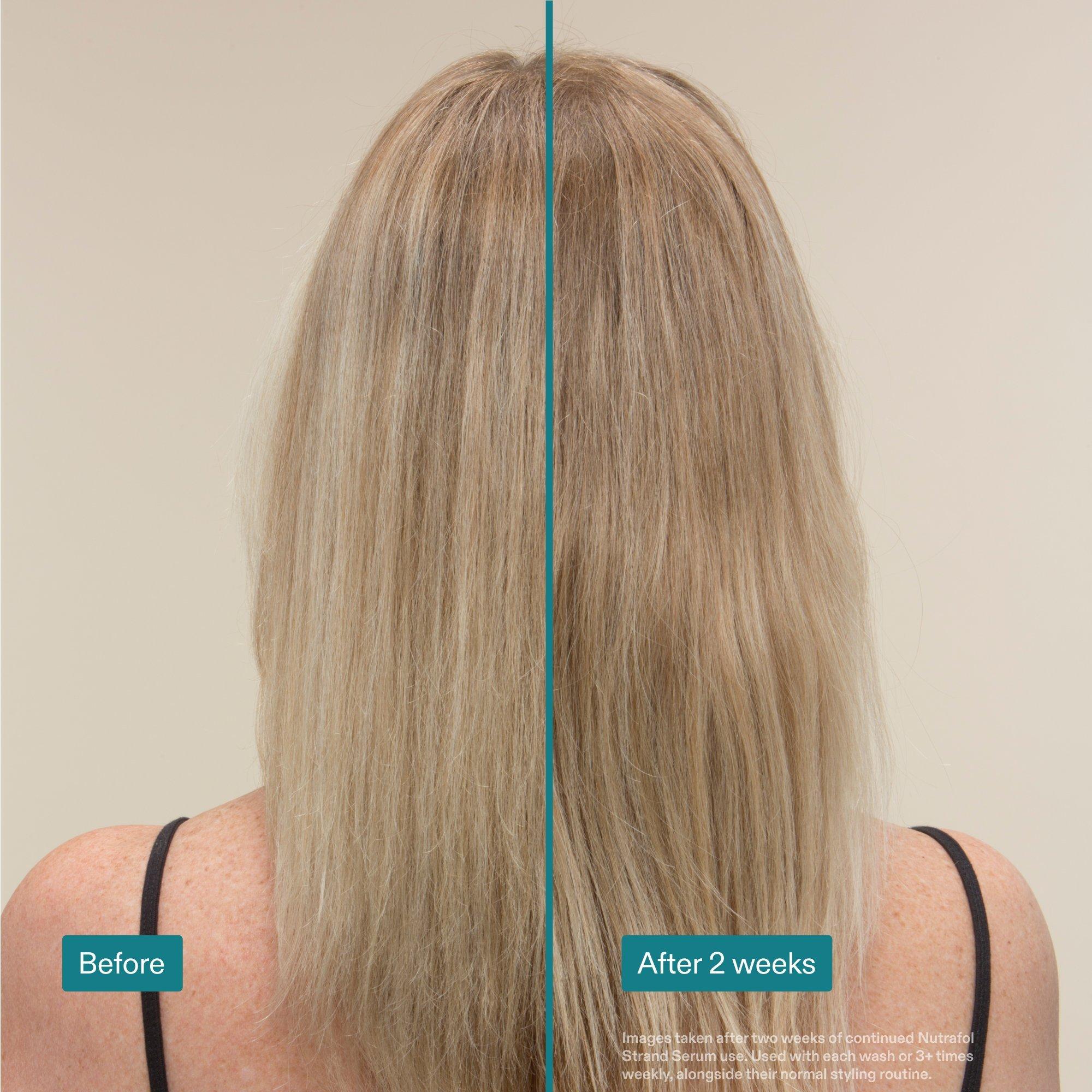 NUTRAFOL Strand Serum Hair Strengthening Kit — фото 4