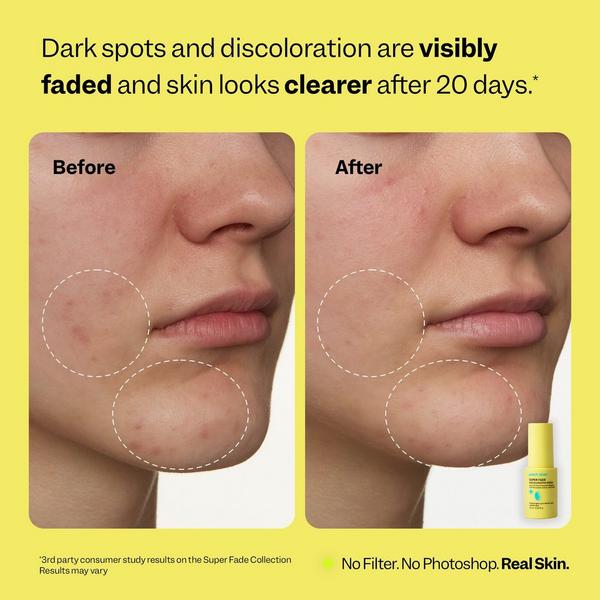 Peach Slices On-The-Glow Treatment Trio #5