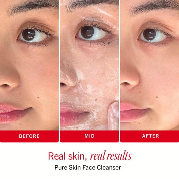 First Aid Beauty Sensitive Skin Bestsellers – Skincare Routine Travel Set #5
