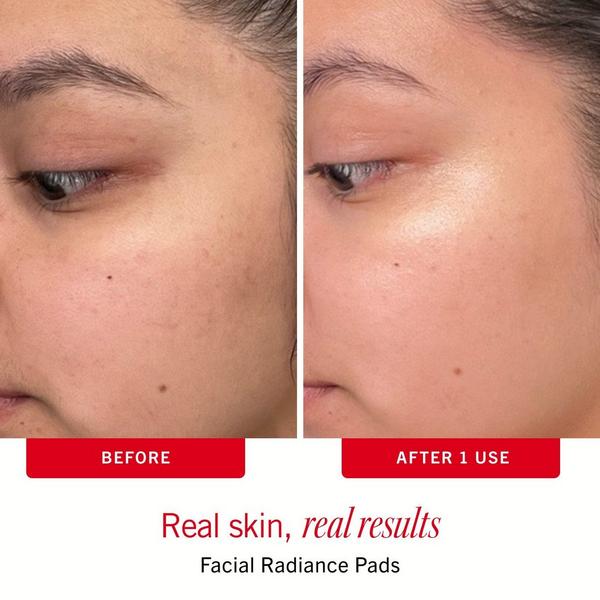 First Aid Beauty Sensitive Skin Bestsellers – Skincare Routine Travel Set #7