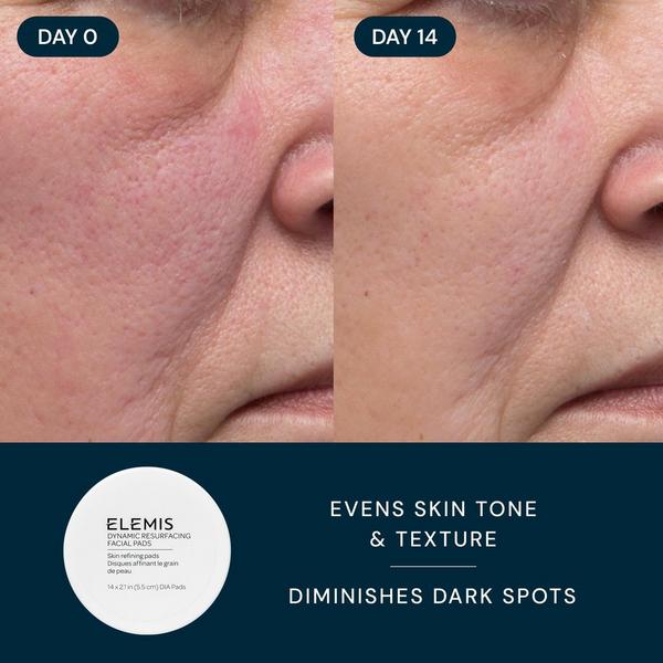 ELEMIS The Bestsellers Set #5