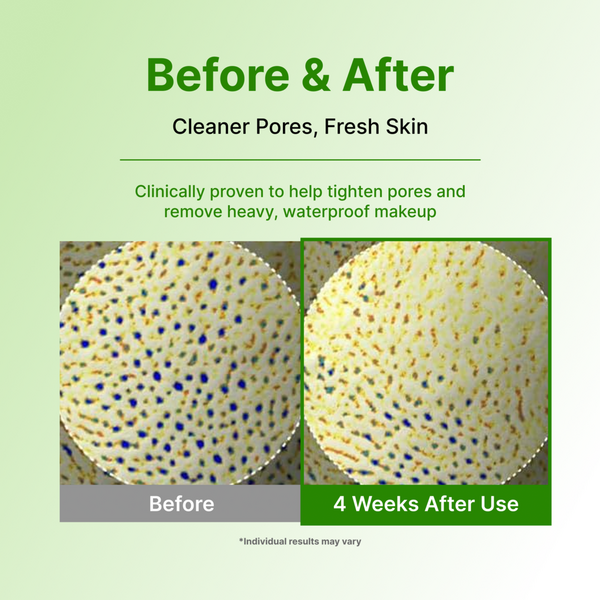 Centellian24 Madeca Matcha Pore Cleansing Oil #6