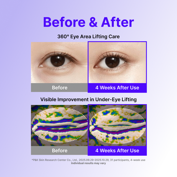Centellian24 360° Shot PDRN Lifting Eye Cream #6