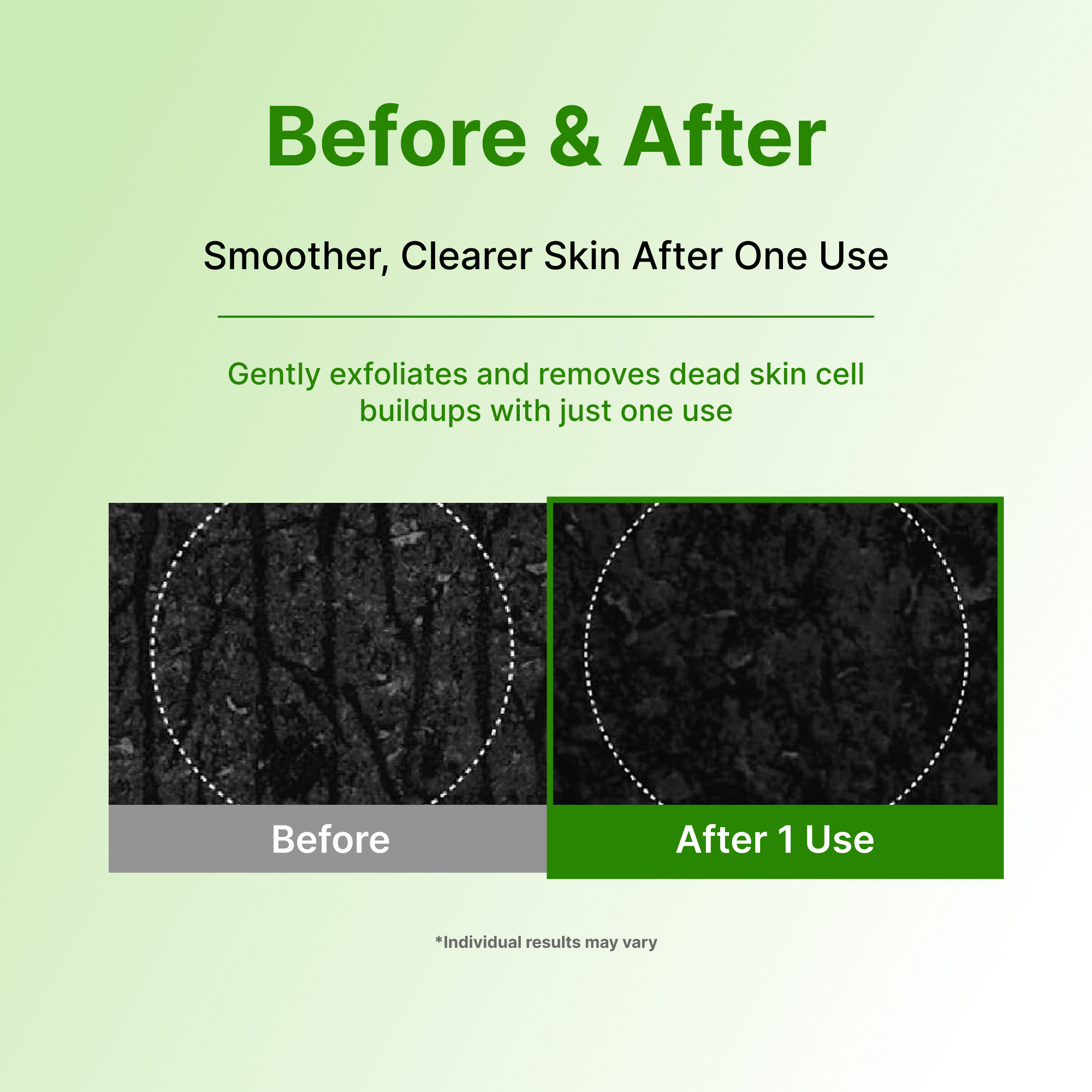Пилинг-гель для лица с матчей Centellian24 Madeca Matcha Toning — фото 6
