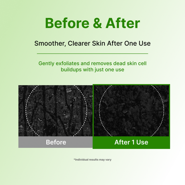 Centellian24 Madeca Matcha Toning Peeling Gel #6