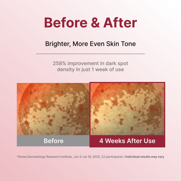 Centellian24 Expert Madeca Mela Capture Ampoule Max #6
