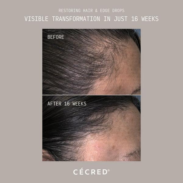 CÉCRED Restoring Hair & Edge Drops XL #2