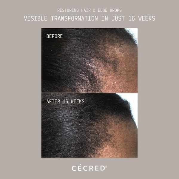 CÉCRED Restoring Hair & Edge Drops XL #3