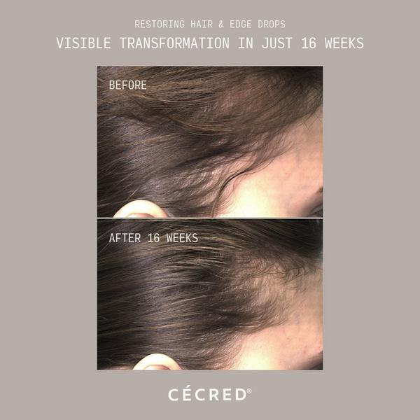 CÉCRED Restoring Hair & Edge Drops XL #4