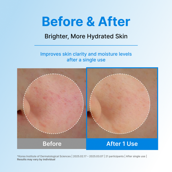 Centellian24 Madeca Lab Hyal Waterfull Glow Gel Mask #6
