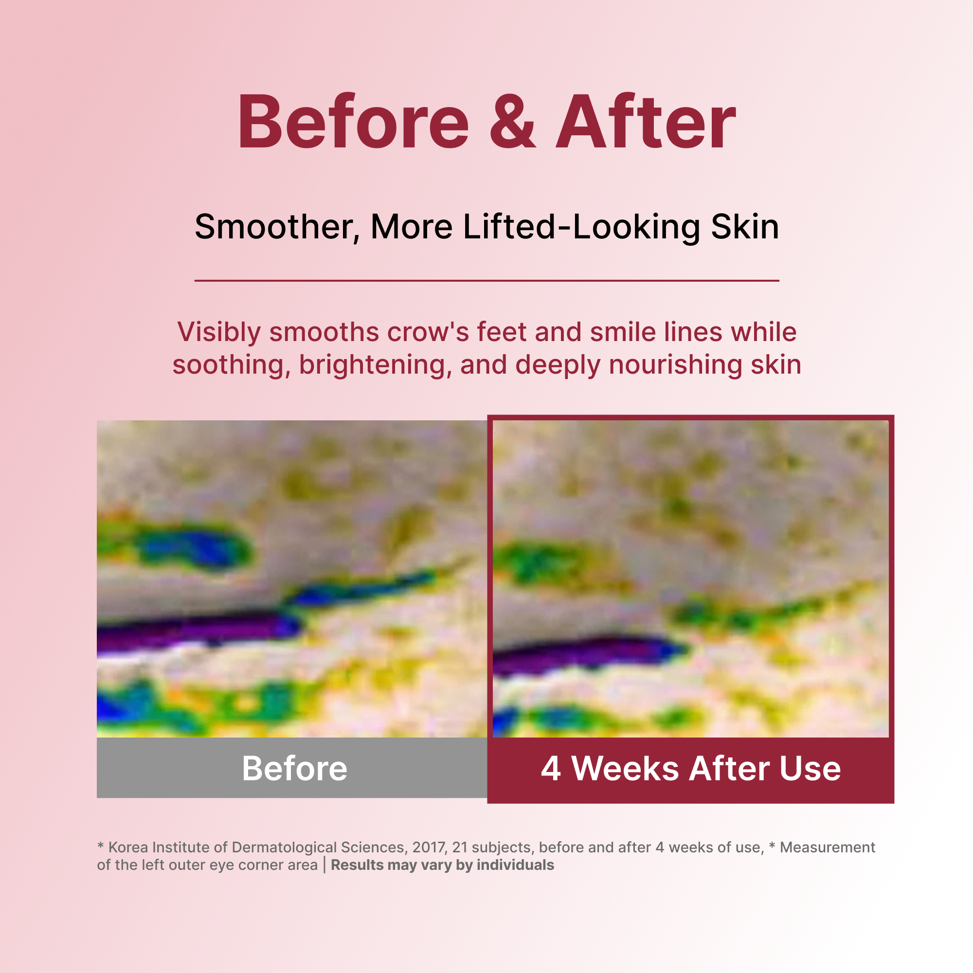Лифтинг-маска для лица Centellian24 Madeca Derma Intensive Lifting Formula — фото 6