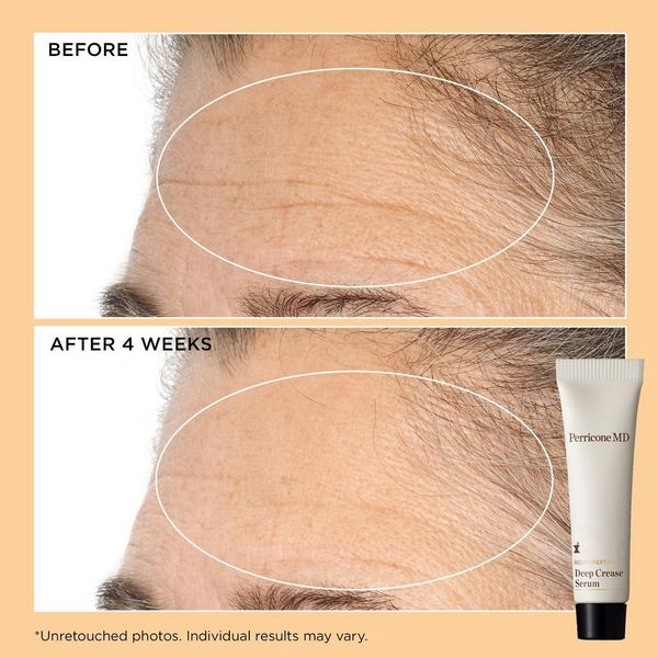 Perricone MD Neuropeptide Firm & Lift Set #3
