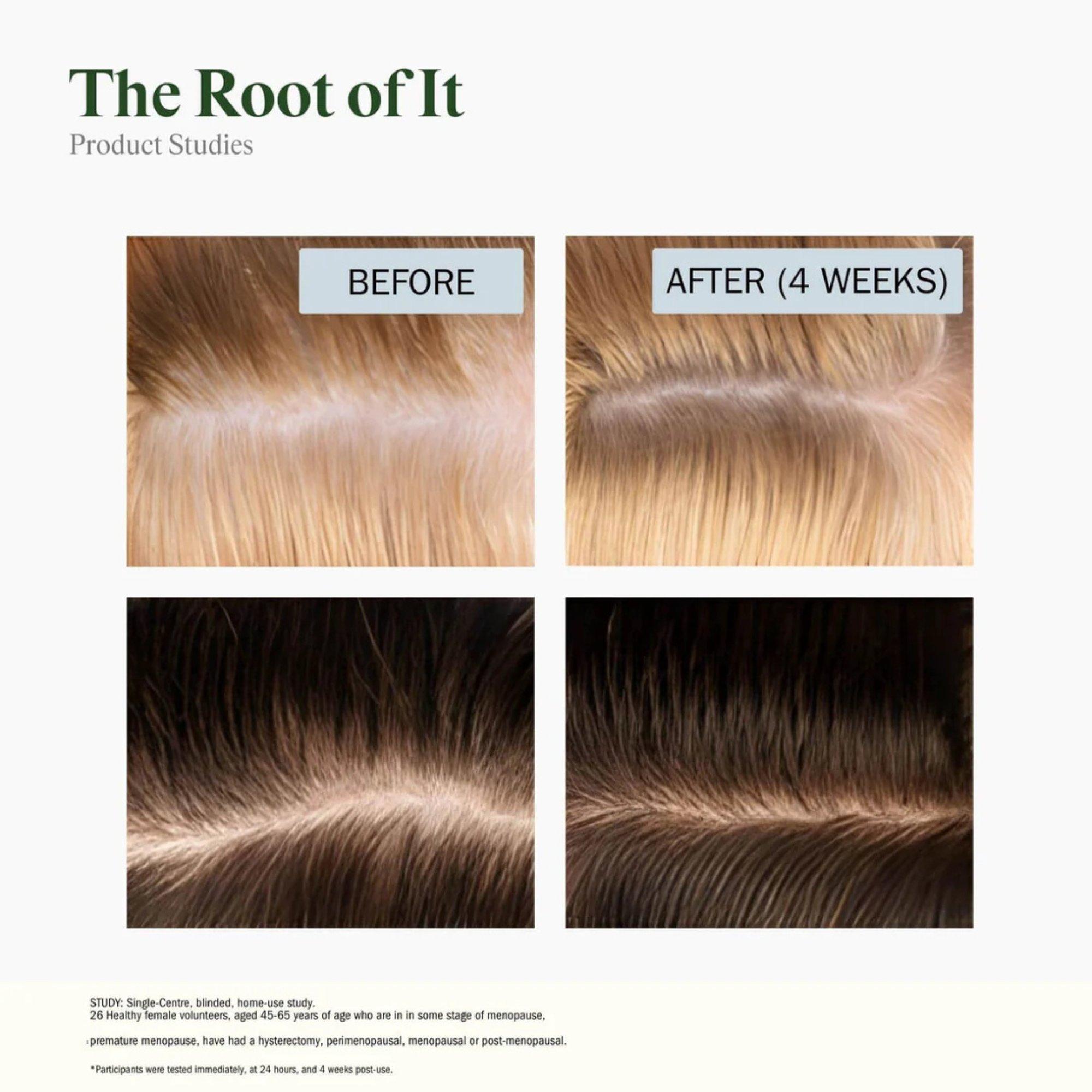 Сыворотка для кожи головы Stripes Beauty by Naomi Watts The Root Of It с эктоином — фото 6
