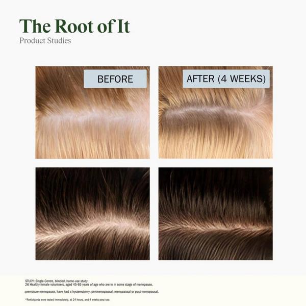 STRIPES BEAUTY by Naomi Watts The Root Of It Ectoine Thickening Scalp Serum #6