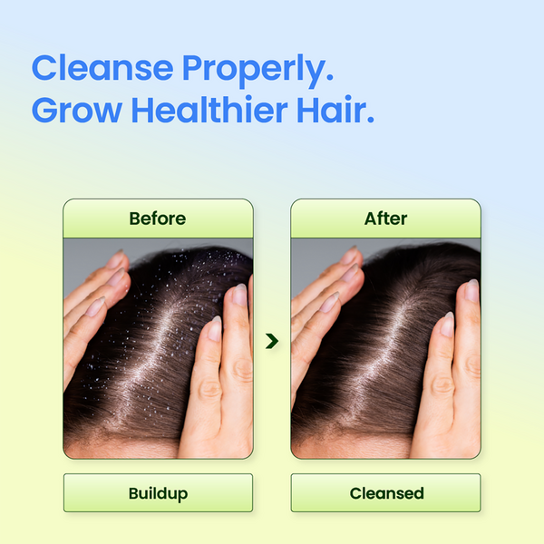 Seapuri Scalpy Root Vital Volume Shampoo #4