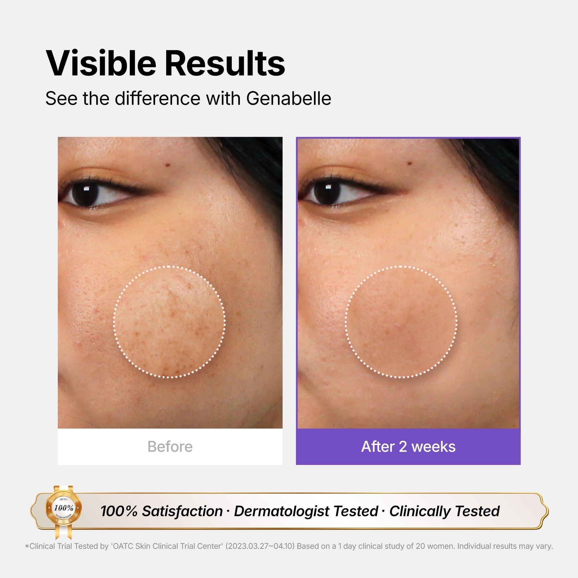 Genabelle Melacare Intensive Cream for Dark Spots & Hyperpigmentation — фото 5