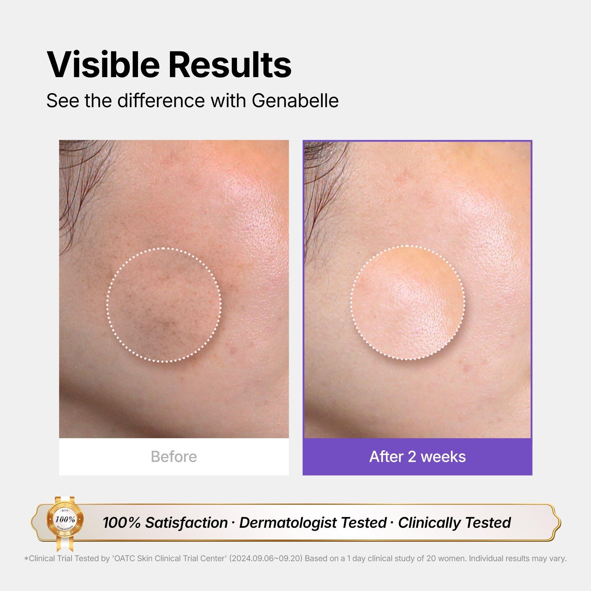 Двусторонние пэды от пигментных пятен и гиперпигментации Genabelle Melacare Jelly Touch — фото 5