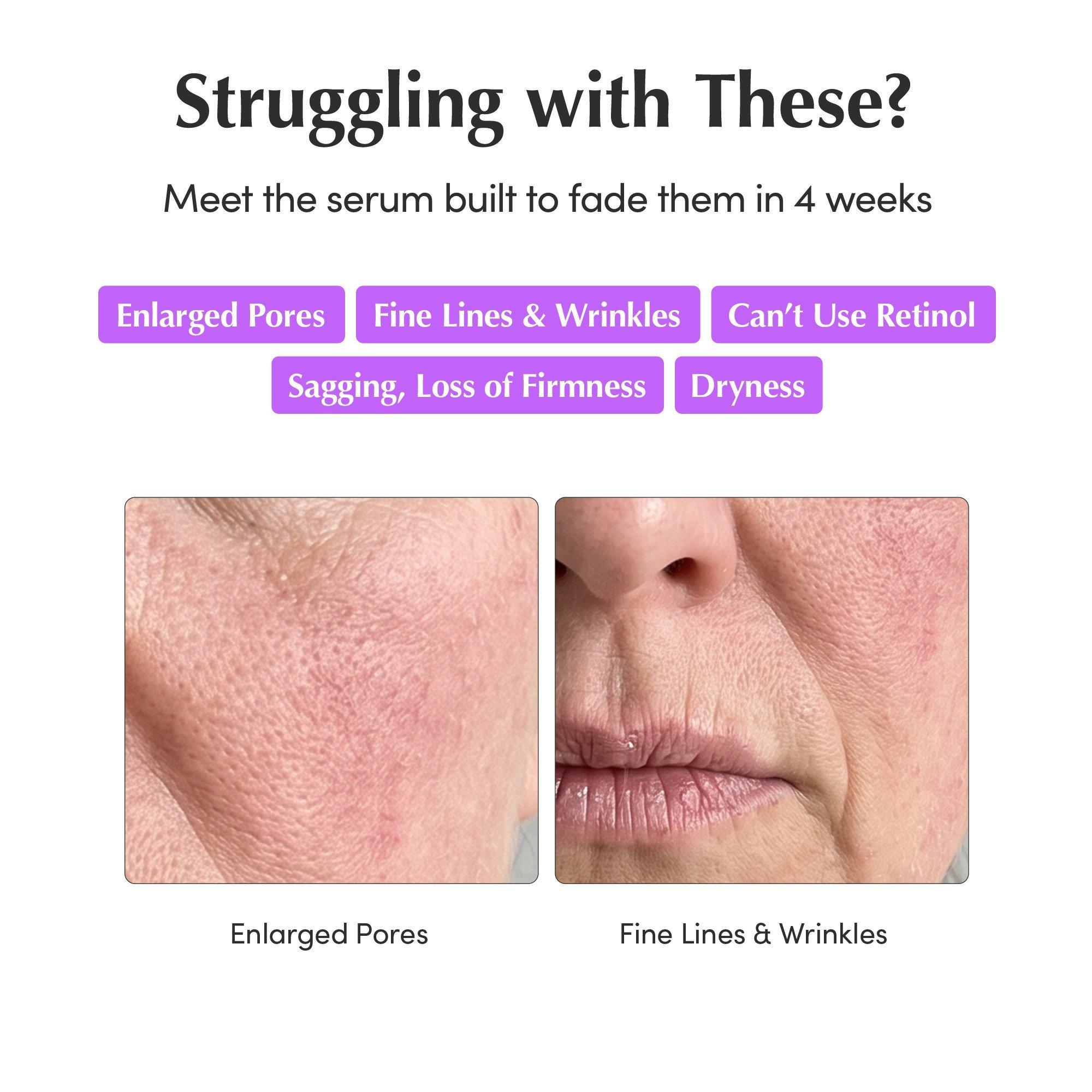 EQQUALBERRY Bakuchiol Plumping & Pore Refining Serum — фото 7