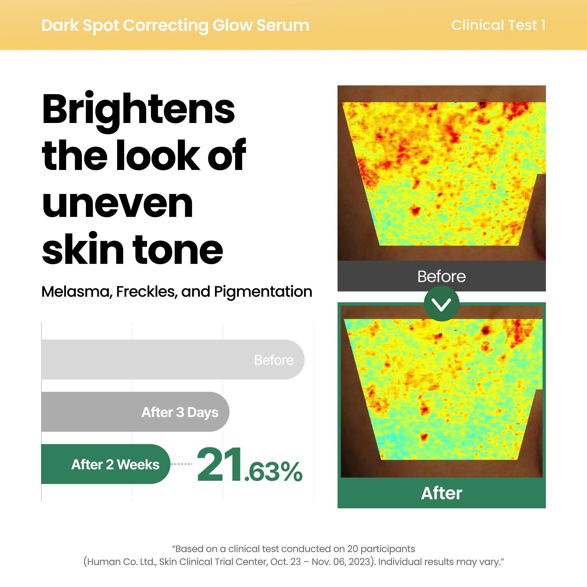 AXIS-Y Dark Spot Correcting Glow Serum — фото 4