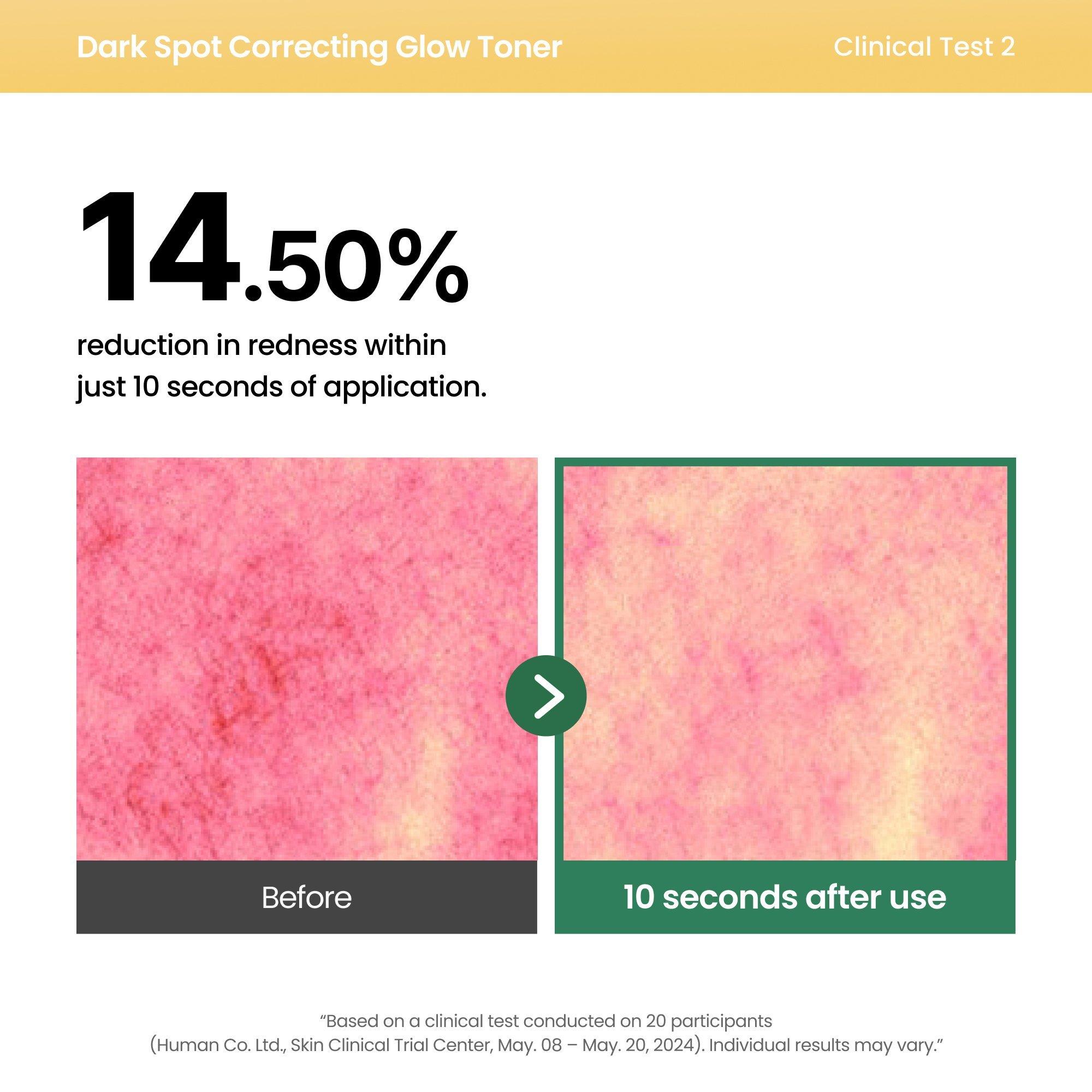 AXIS-Y Dark Spot Correcting Glow Toner — фото 4