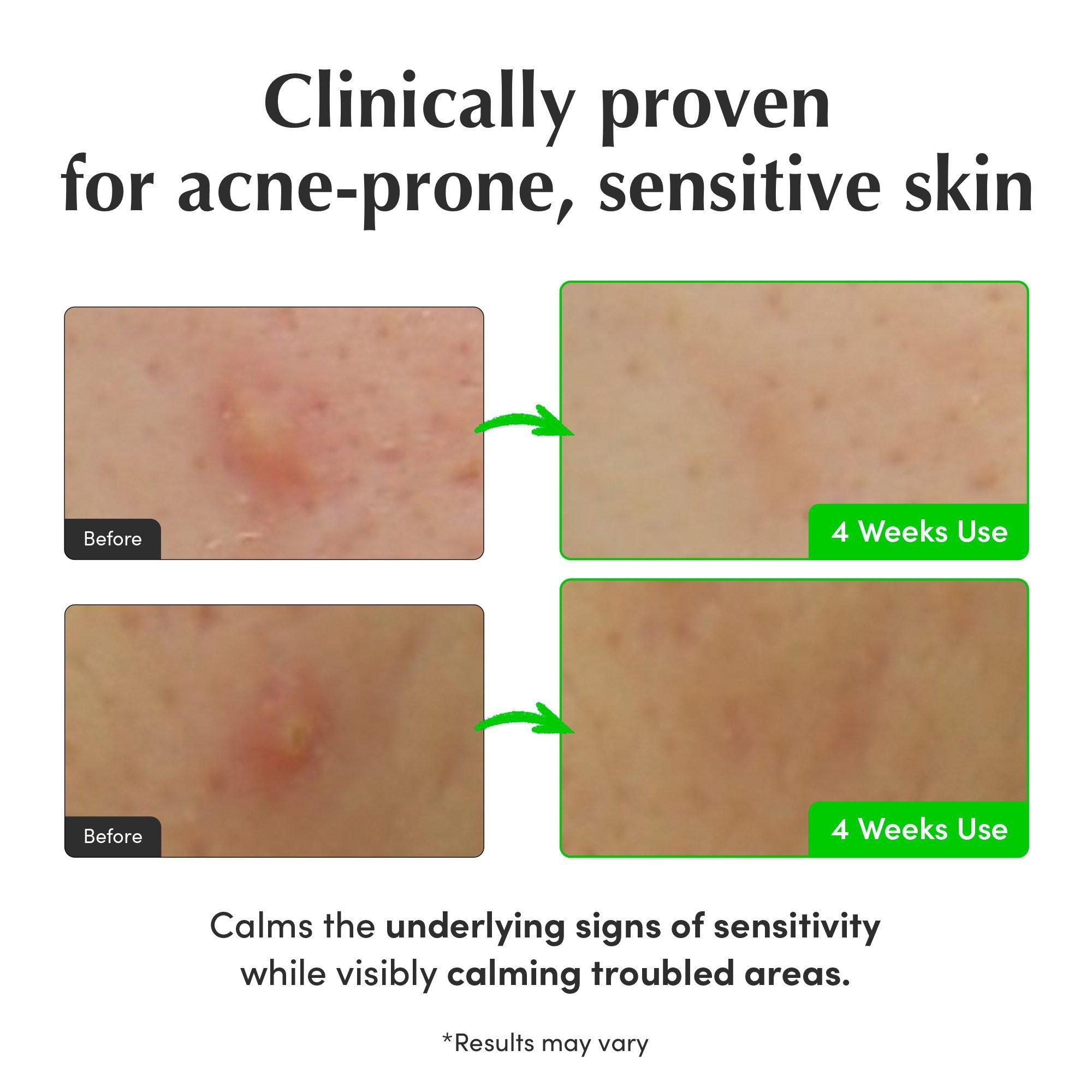 EQQUALBERRY Aloe Pdrn Calming Toner — фото 6