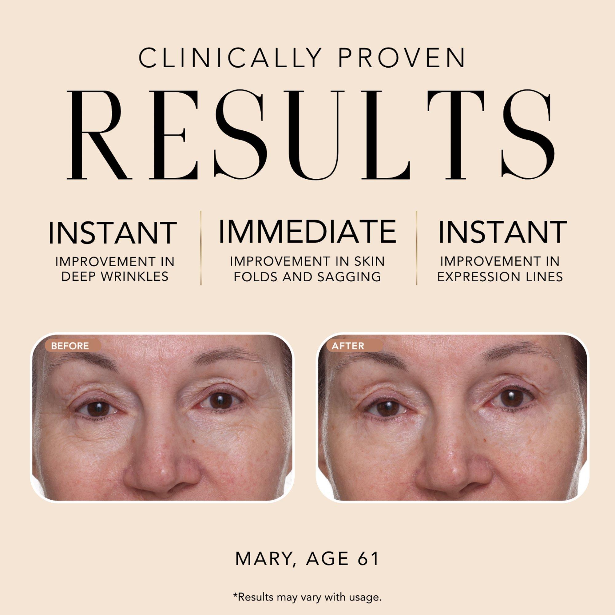 NAKERY BEAUTY SkinRepair Retinol Deep Wrinkle Serum with NAD+ — фото 3