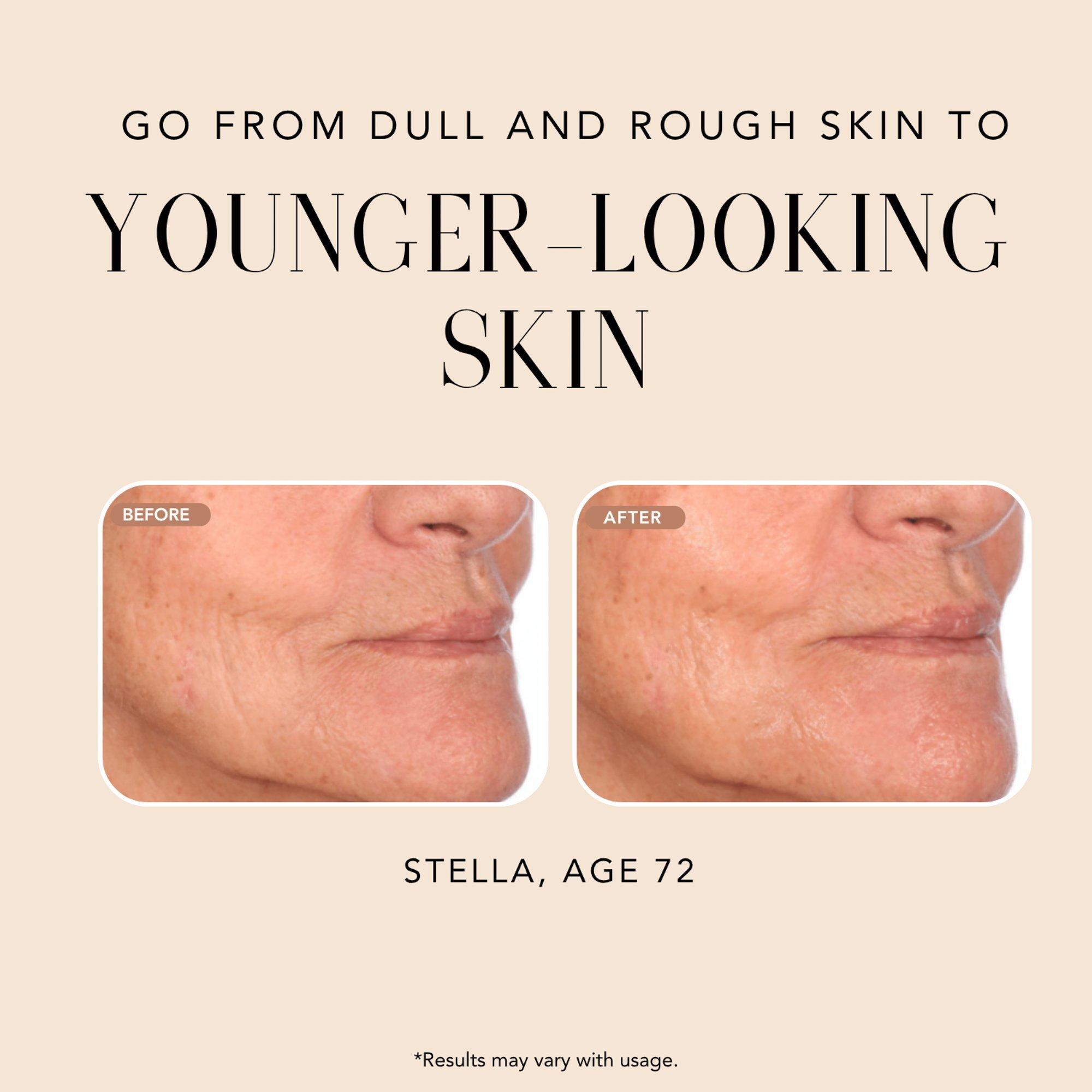 NAKERY BEAUTY Advanced Resurfacing Microderm Treatment — фото 3