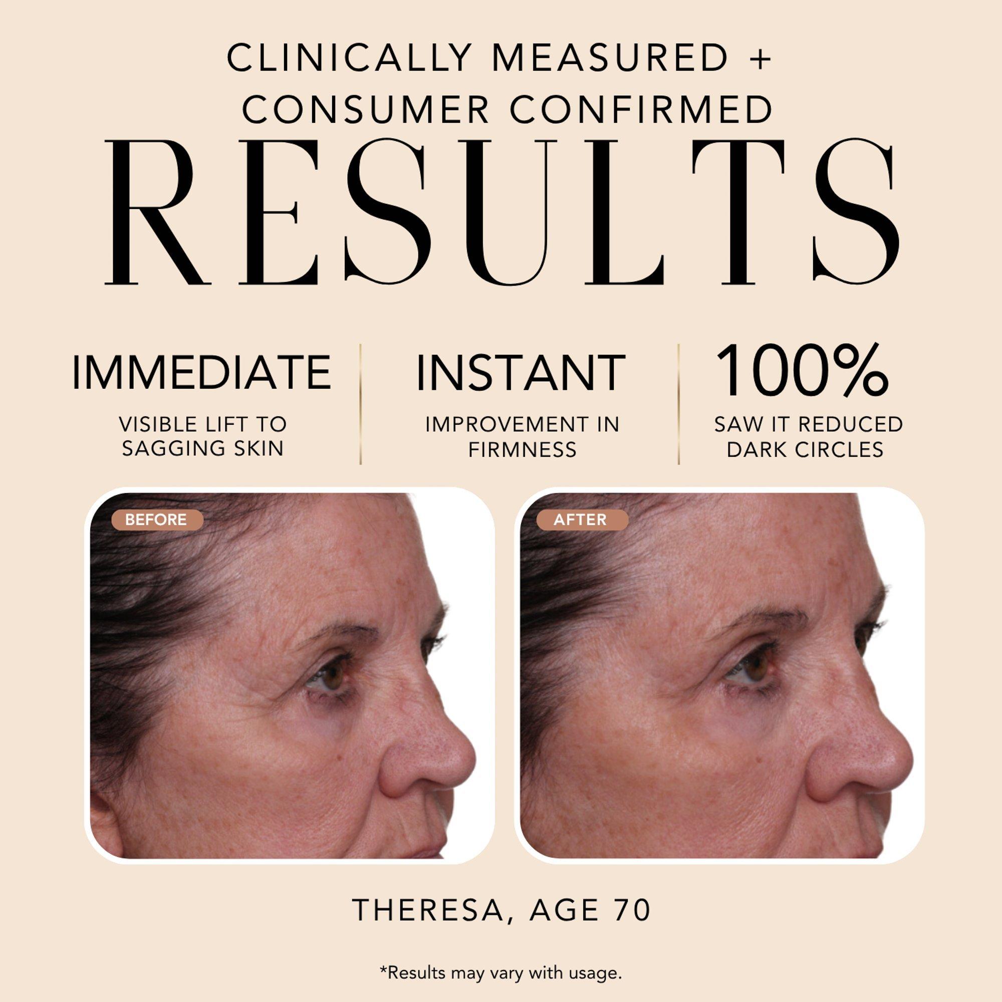 NAKERY BEAUTY Lift-TOX Anti-Gravity 360 Eye Lift Cream — фото 3
