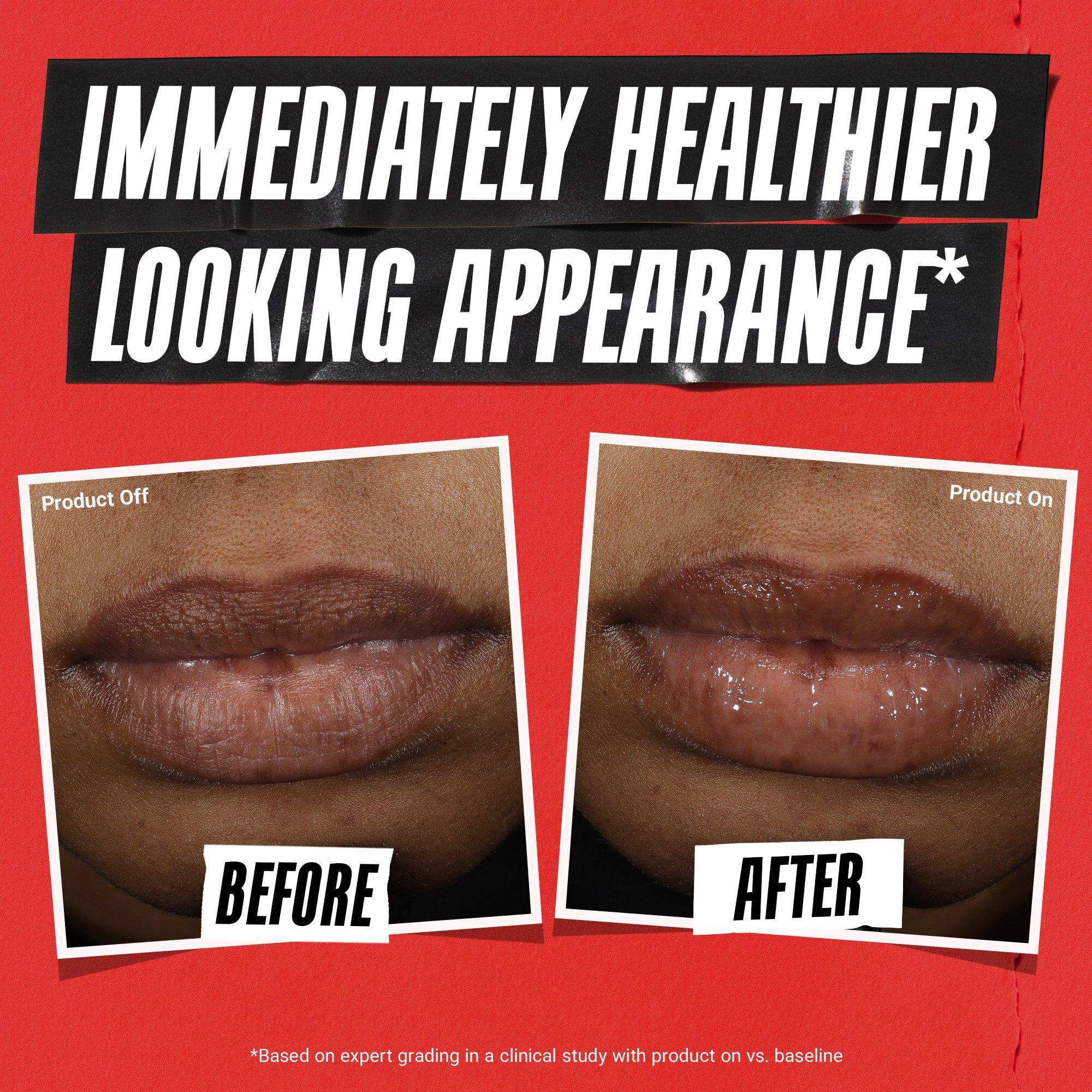 Kiehl's Since 1851 Ultra Medicated Mending Lip Gel — фото 6