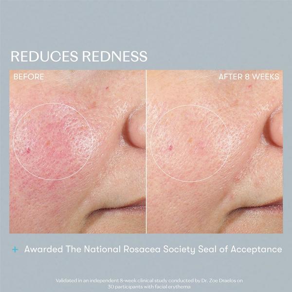 RescueMD Skin Rescue Set #5