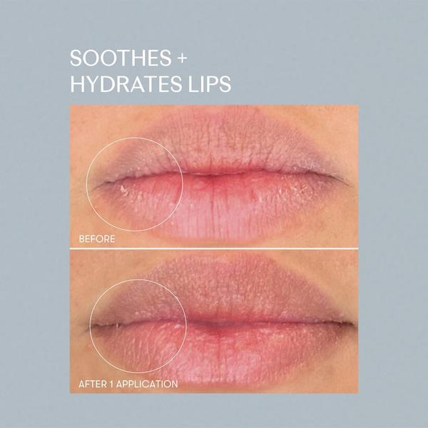 RescueMD Skin Rescue Set #7