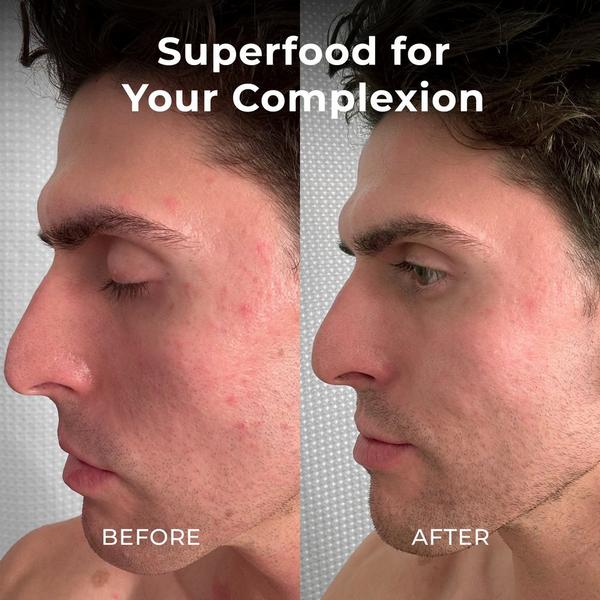 Miami Beach Bum Skin Smoothie #4