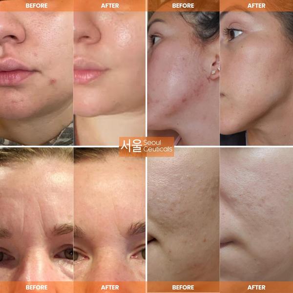 Seoul Ceuticals Korean Skin Care Multi-Function All-In-One Anti-Aging Snail Repair Cream #3