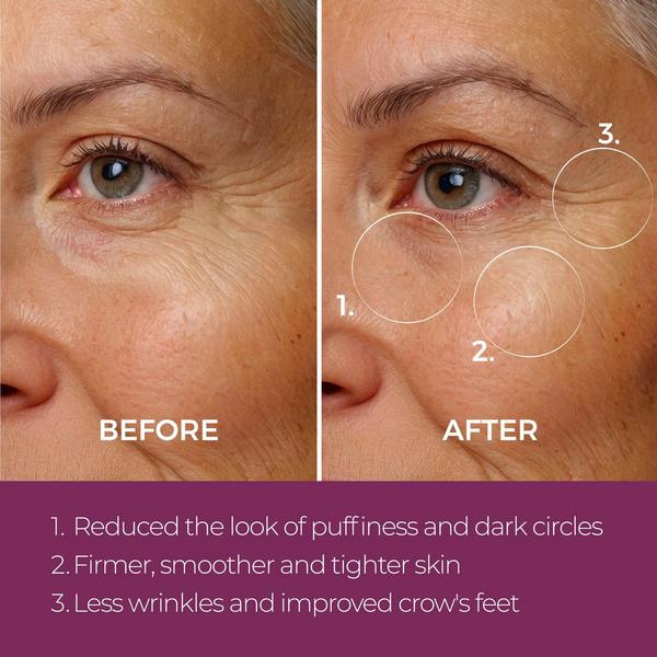 Blinc Eye Repair Peptide Complex #3