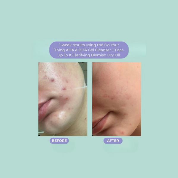 Evre Skincare Face Up To It Clarifying Dry Oil for Teens #5