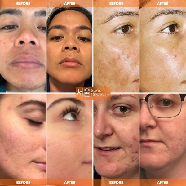 Seoul Ceuticals Korean Skin Care Day Glow Serum #3