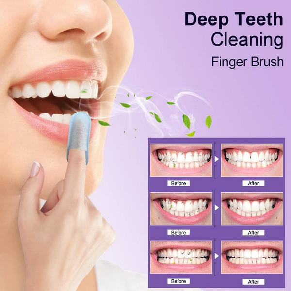 MySmile Deep Cleaning Teeth Wipes On-the-Go Tooth Cleaner #2