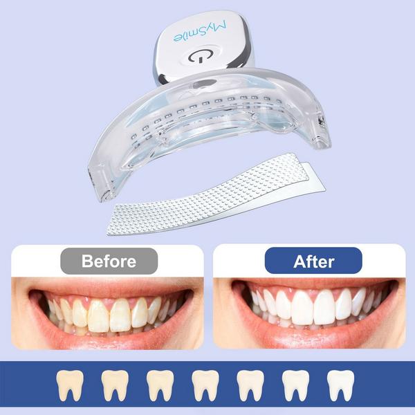 MySmile Teeth Whitening Strips with LED Light Kit #4