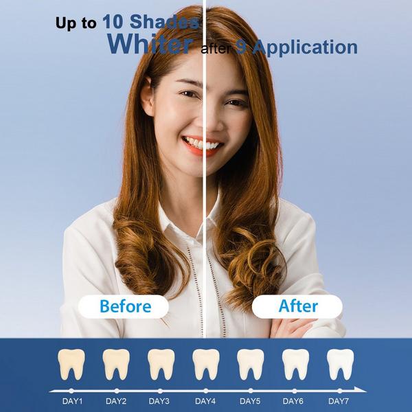 MySmile Teeth Whitening Gel Refill Pack with 18% CP #6