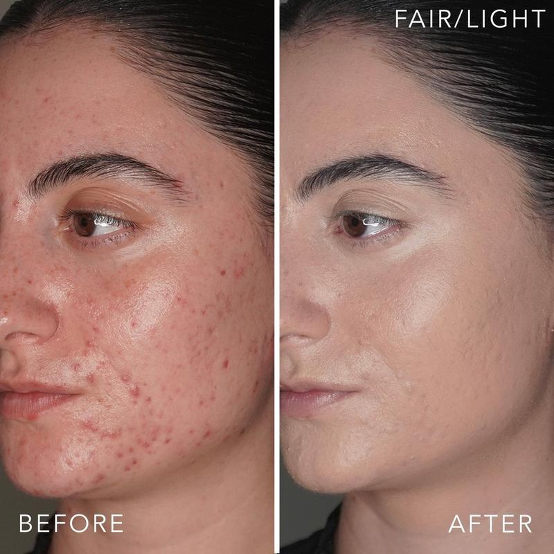 Doll 10 - Fair/Light T.C.E This Covers Everything Super Coverage