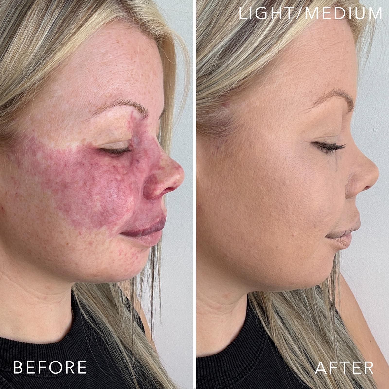 T.C.E This Covers Everything Super Coverage Serum Makeup with Peptides - Light/Medium