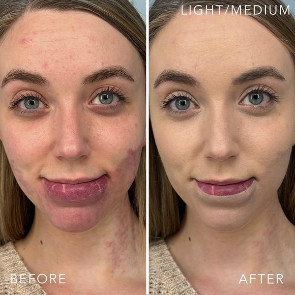 Doll 10 T.C.E Liquid Filter #3