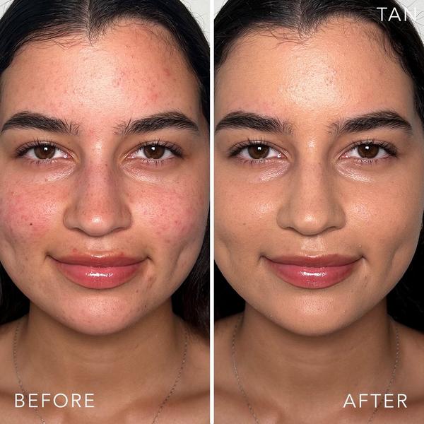 Doll 10 Doll Skin Genius Serum Skin Tint With Reishi Mushroom #3
