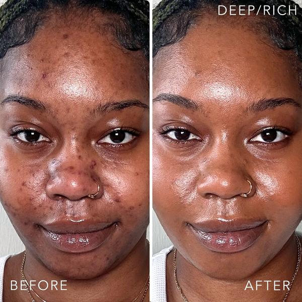 Doll 10 T.C.E Liquid Filter #3