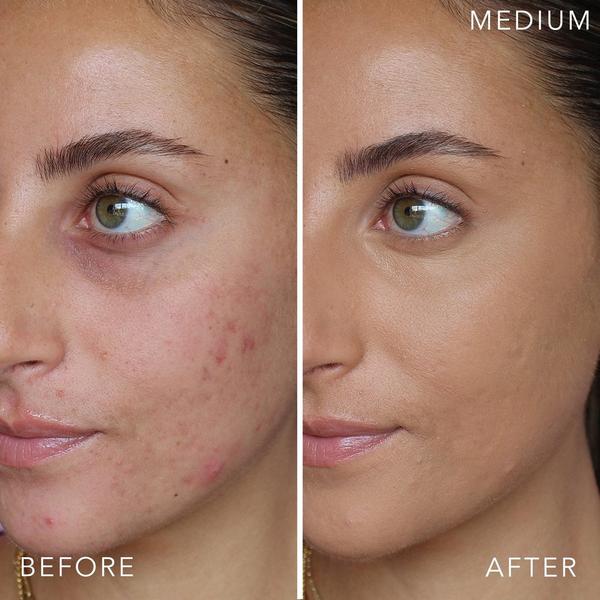 Doll 10 T.C.E This Covers Everything Super Coverage Concealer With Peptides #3